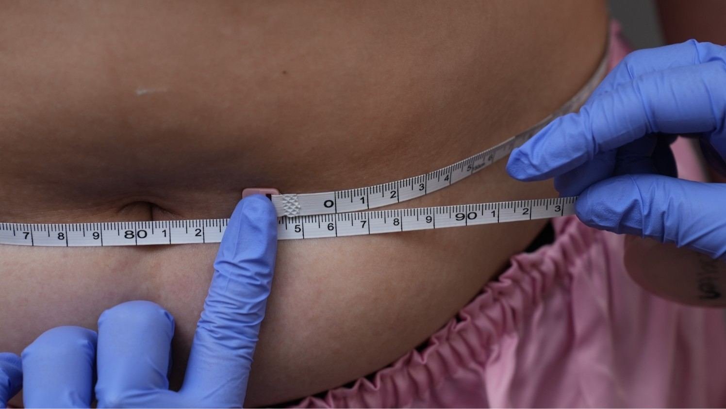 Klinik Slimming di Bekasi