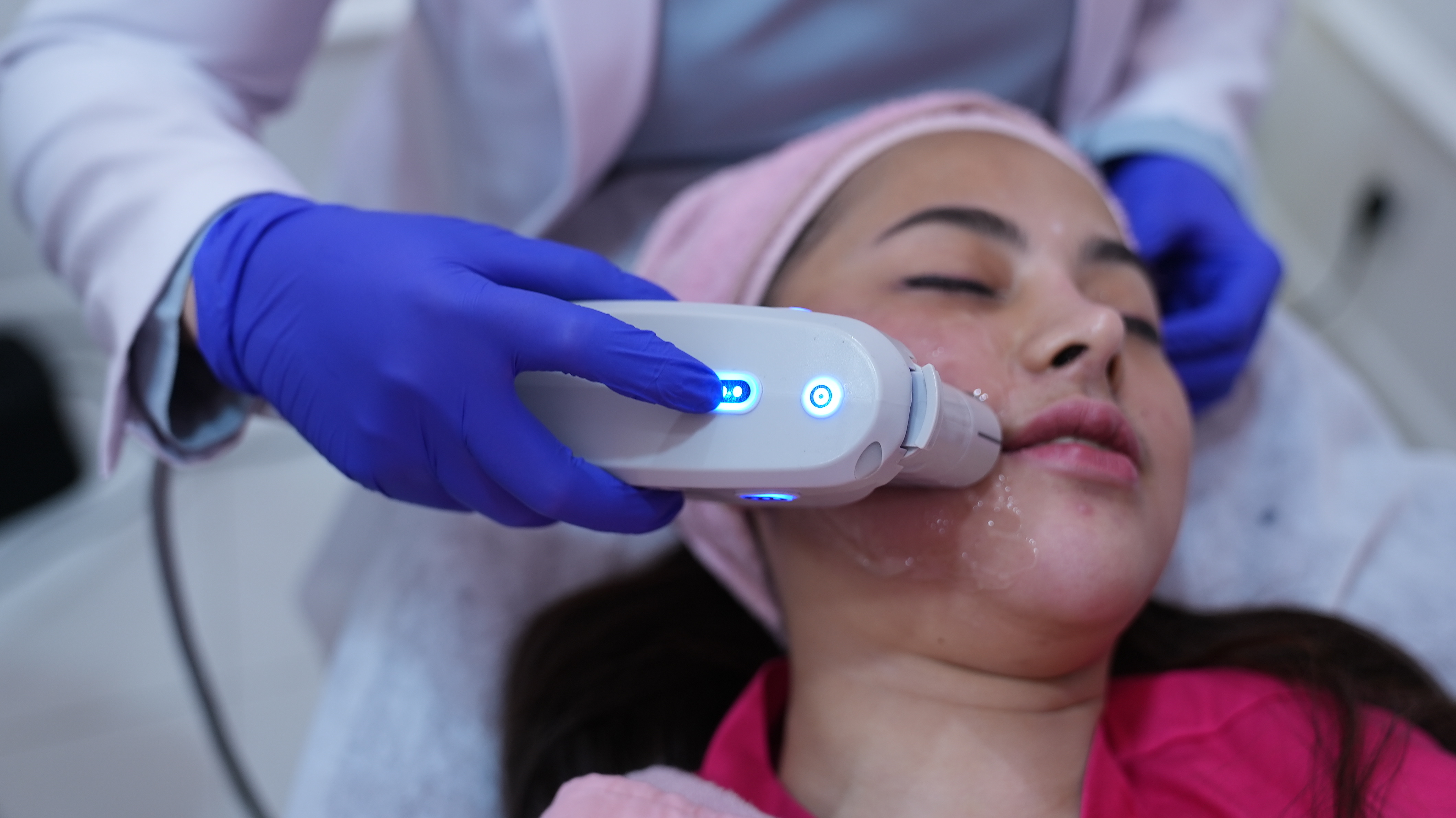 Apa Itu Wajah V Shape HIFU