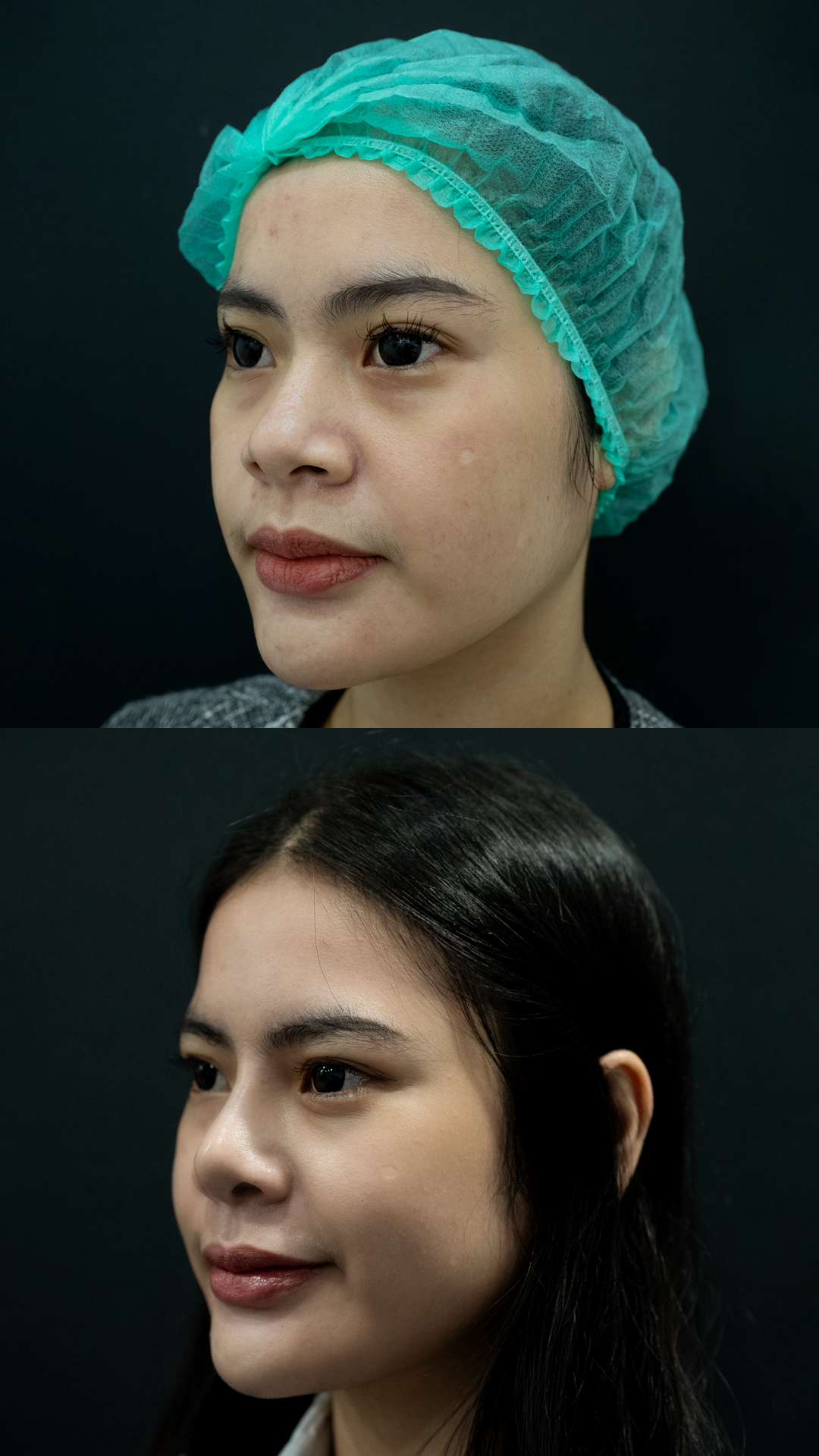 Klinik V Shape Face Terbaik