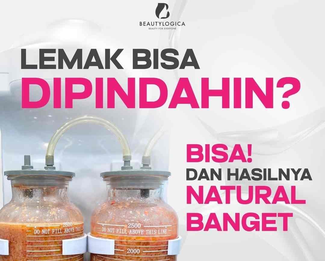 Fat Transfer di Jakarta