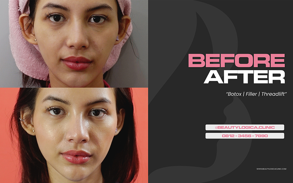 Beautylogica Slider 3