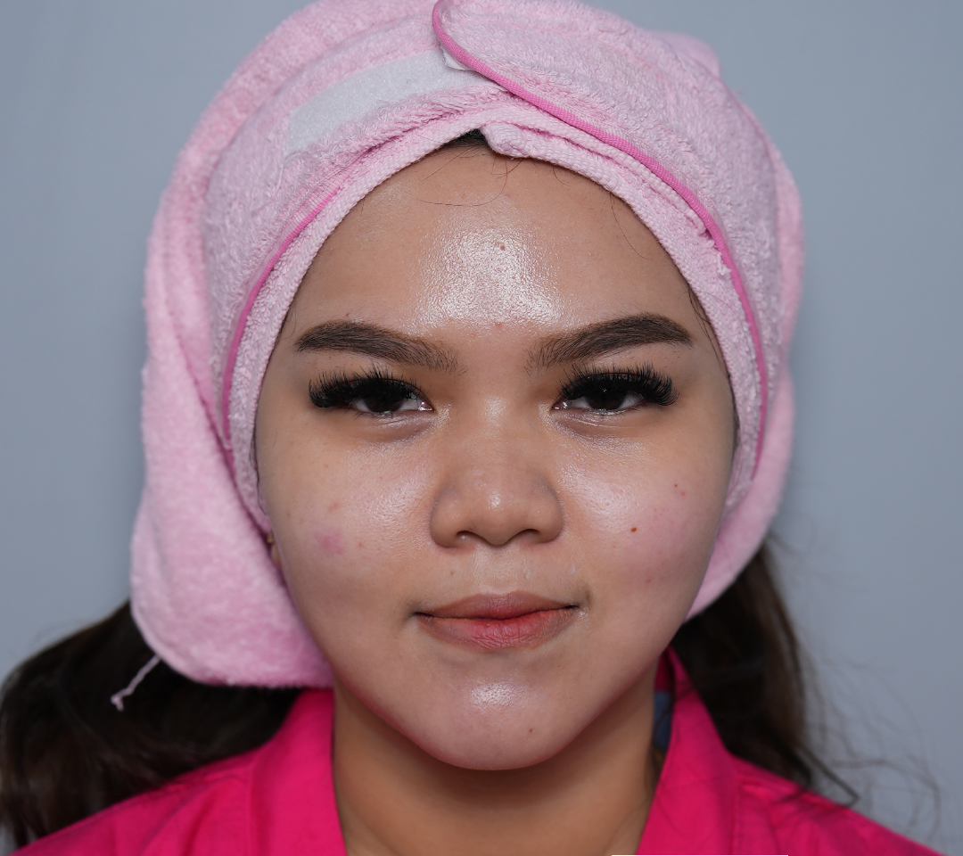 Treatment Kecantikan untuk Wajah Tirus
