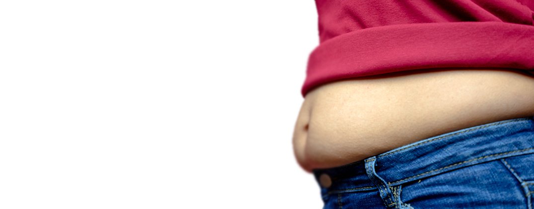 Tummy Tuck